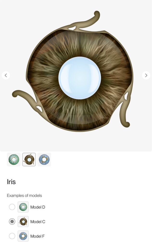 Aniridi İol, İris Lens, İris protez
